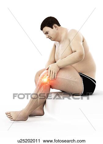 Stock Image - Obese man with knee pain, computer illustration.. Fotosearch