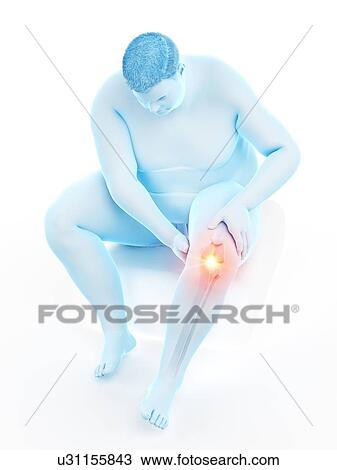 Stock Image - Obese man with knee pain, computer illustration.. Fotosearch