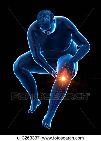 Obese man with knee pain, computer illustration. View Large Photo Image Stock Photo - Obese man with knee pain, computer illustration.. Fotosearch