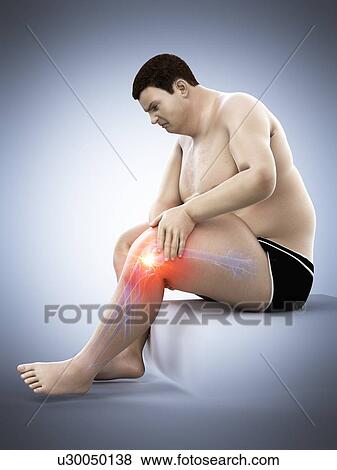 Obese man with knee pain, computer illustration. View Large Photo Image Stock Photo - Obese man with knee pain, computer illustration.. Fotosearch