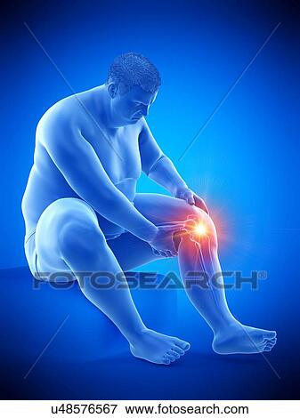 Obese man with knee pain, computer illustration. View Large Photo Image Stock Photo - Obese man with knee pain, computer illustration.. Fotosearch