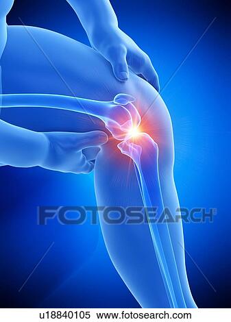 Stock Photography - Obese man with knee pain, computer illustration.. Fotosearch
