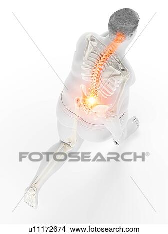 Picture - Obese runner with back pain, computer illustration.. Fotosearch