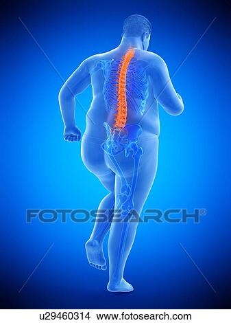 Obese runner with back pain, computer illustration. View Large Photo Image Picture - Obese runner with back pain, computer illustration.. Fotosearch