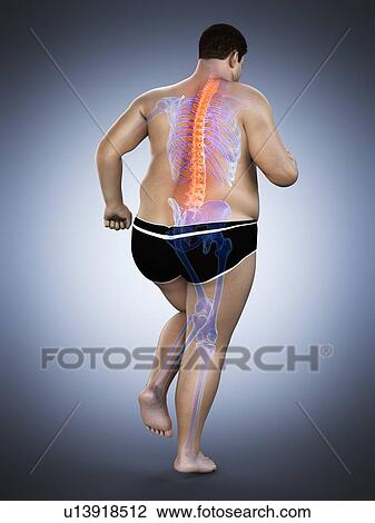 Stock Image - Obese runner with back pain, computer illustration.. Fotosearch