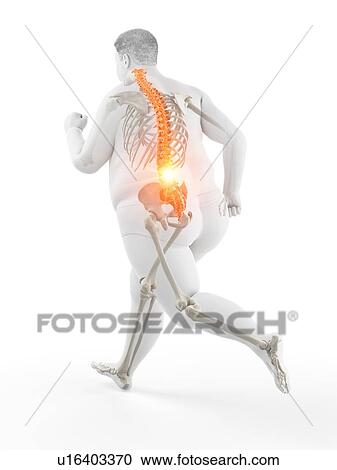 Stock Image - Obese runner with back pain, computer illustration.. Fotosearch