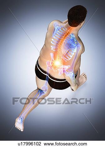 Stock Image - Obese runner with back pain, computer illustration.. Fotosearch