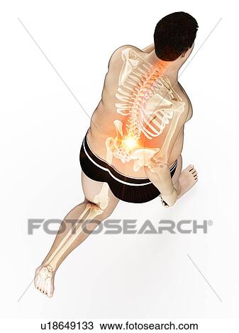 Obese runner with back pain, computer illustration. View Large Photo Image Stock Image - Obese runner with back pain, computer illustration.. Fotosearch