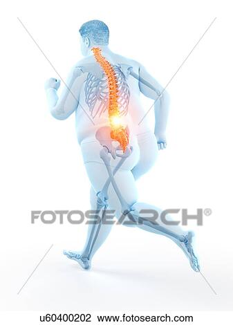 Stock Image - Obese runner with back pain, computer illustration.. Fotosearch