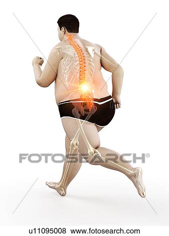 Obese runner with back pain, computer illustration. View Large Photo Image Stock Photo - Obese runner with back pain, computer illustration.. Fotosearch