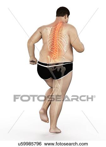 Stock Photograph - Obese runner with back pain, computer illustration.. Fotosearch