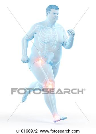 Stock Image - Obese runner with joint pain, computer illustration.. Fotosearch