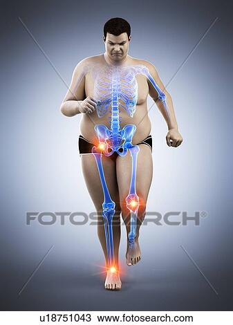 Obese runner with joint pain, computer illustration. View Large Photo Image Stock Image - Obese runner with joint pain, computer illustration.. Fotosearch