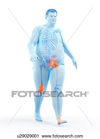 Stock Image - Obese runner with joint pain, computer illustration.. Fotosearch