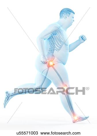Obese runner with joint pain, computer illustration. View Large Photo Image Stock Image - Obese runner with joint pain, computer illustration.. Fotosearch
