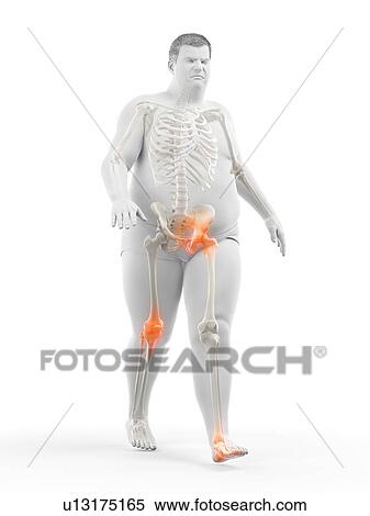 Obese runner with joint pain, computer illustration. View Large Photo Image Stock Photography - Obese runner with joint pain, computer illustration.. Fotosearch