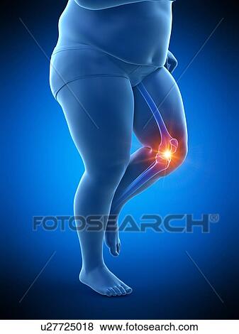 Obese runner with knee pain, computer illustration. View Large Photo Image Stock Photo - Obese runner with knee pain, computer illustration.. Fotosearch