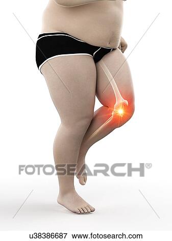 Obese runner with knee pain, computer illustration. View Large Photo Image Stock Photo - Obese runner with knee pain, computer illustration.. Fotosearch