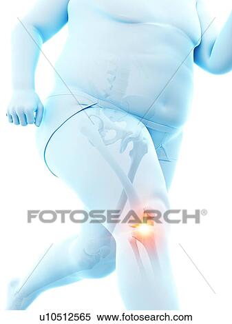 Stock Photography - Obese runner with knee pain, computer illustration.. Fotosearch