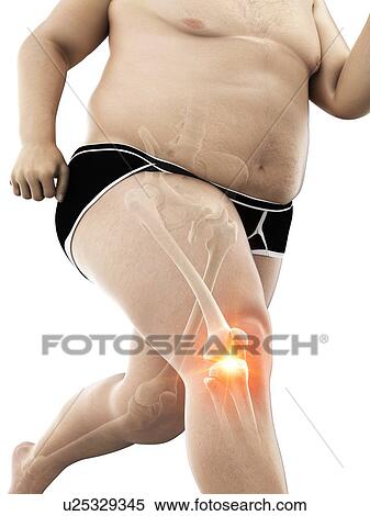 Obese runner with knee pain, computer illustration. View Large Photo Image Stock Photography - Obese runner with knee pain, computer illustration.. Fotosearch