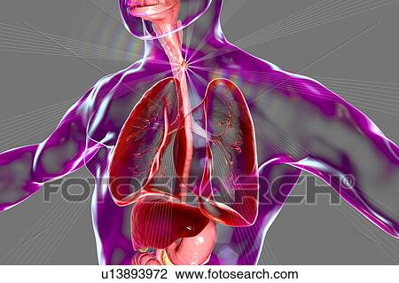 Stock Image - Oesophageal cancer, computer illustration.. Fotosearch