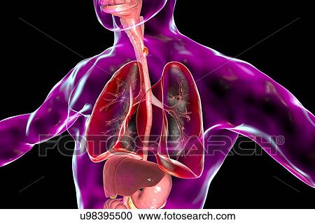 Oesophageal cancer, computer illustration. View Large Photo Image Stock Image - Oesophageal cancer, computer illustration.. Fotosearch