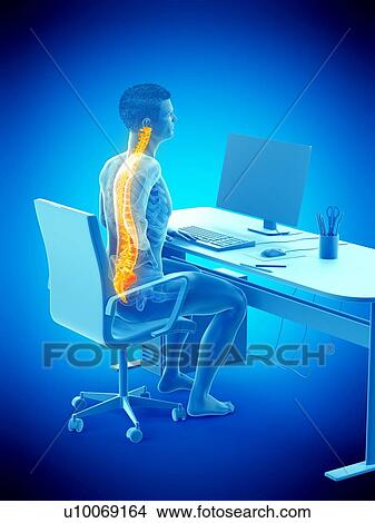 Office worker with back pain, conceptual illustration. View Large Photo Image Picture - Office worker with back pain, conceptual illustration.. Fotosearch
