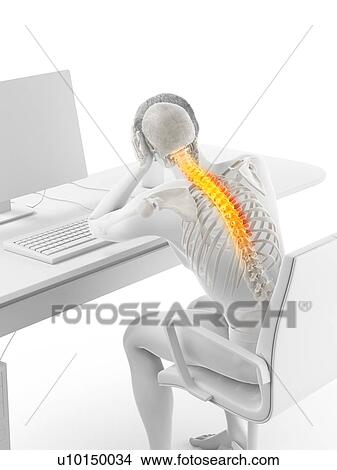 Picture - Office worker with back pain, conceptual illustration.. Fotosearch