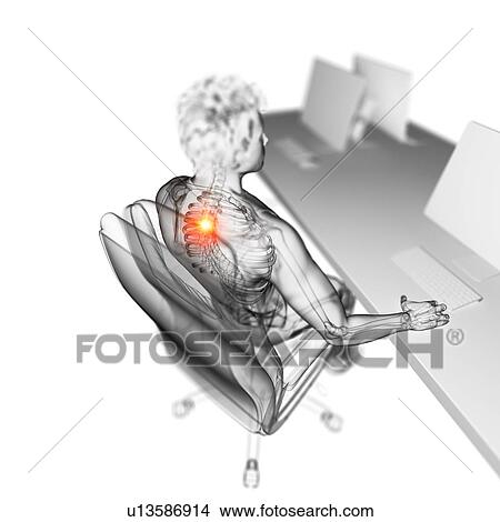 Picture - Office worker with back pain, illustration. Fotosearch