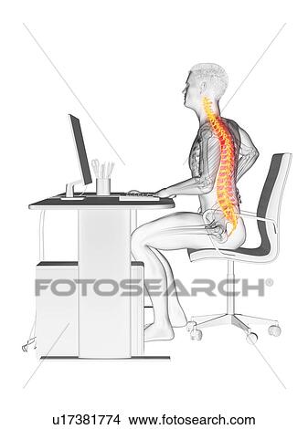 Picture - Office worker with back pain, conceptual illustration.. Fotosearch