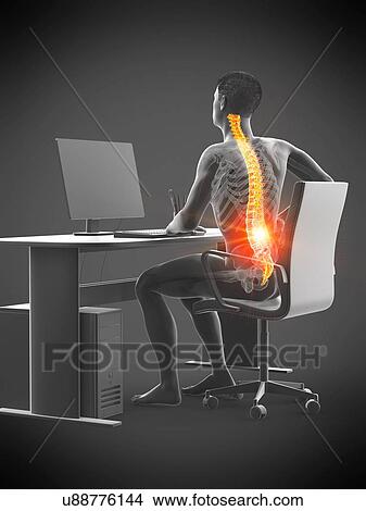 Picture - Office worker with back pain, conceptual illustration.. Fotosearch