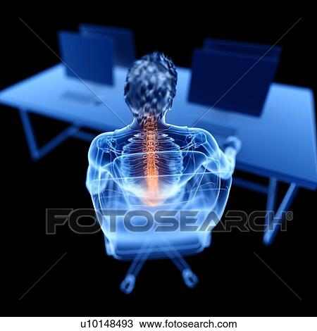 Office worker with back pain, illustration View Large Photo Image Stock Image - Office worker with back pain, illustration. Fotosearch