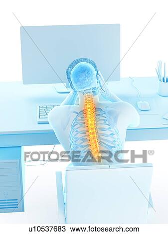 Stock Image - Office worker with back pain, conceptual illustration.. Fotosearch