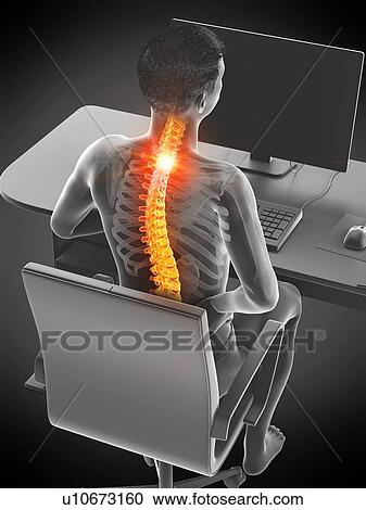 Office worker with back pain, conceptual illustration. View Large Photo Image Stock Image - Office worker with back pain, conceptual illustration.. Fotosearch
