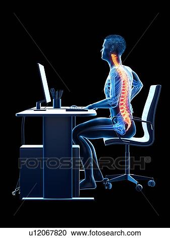 Office worker with back pain, conceptual illustration. View Large Photo Image Stock Image - Office worker with back pain, conceptual illustration.. Fotosearch