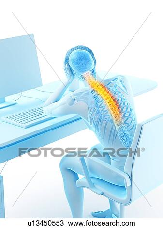 Office worker with back pain, conceptual illustration. View Large Photo Image Stock Image - Office worker with back pain, conceptual illustration.. Fotosearch
