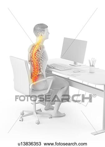 Office worker with back pain, conceptual illustration. View Large Photo Image Stock Image - Office worker with back pain, conceptual illustration.. Fotosearch