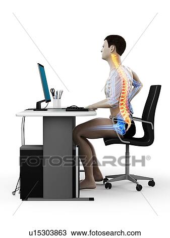 Stock Image - Office worker with back pain, conceptual illustration.. Fotosearch