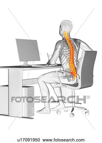 Stock Image - Office worker with back pain, conceptual illustration.. Fotosearch