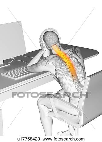 Stock Image - Office worker with back pain, conceptual illustration.. Fotosearch