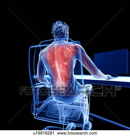 Stock Image - Office worker with back pain, illustration. Fotosearch
