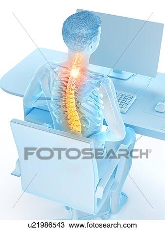 Office worker with back pain, conceptual illustration. View Large Photo Image Stock Image - Office worker with back pain, conceptual illustration.. Fotosearch