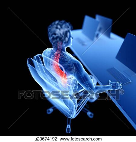 Stock Image - Office worker with back pain, illustration. Fotosearch