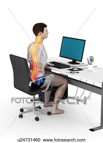 Stock Image - Office worker with back pain, conceptual illustration.. Fotosearch