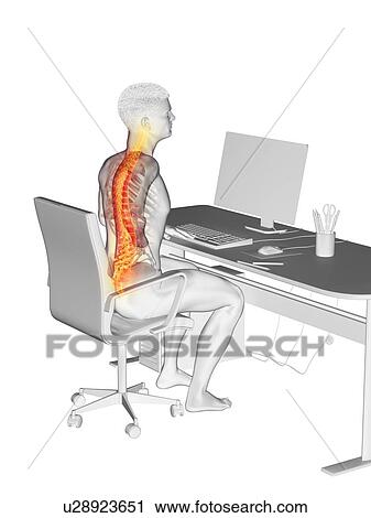Stock Image - Office worker with back pain, conceptual illustration.. Fotosearch
