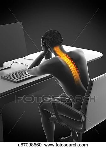 Stock Image - Office worker with back pain, conceptual illustration.. Fotosearch