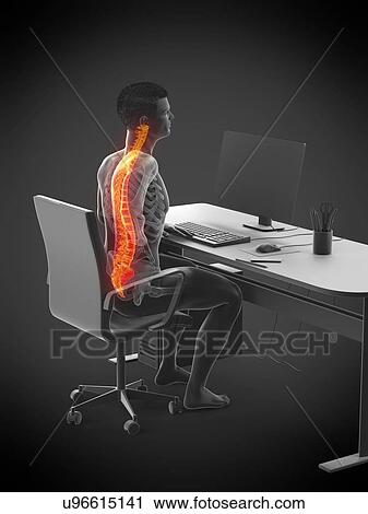 Stock Image - Office worker with back pain, conceptual illustration.. Fotosearch