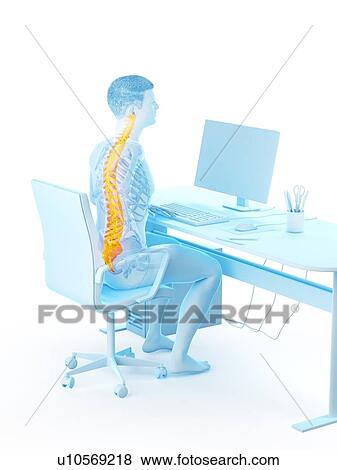 Stock Photo - Office worker with back pain, conceptual illustration.. Fotosearch
