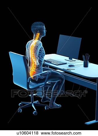 Stock Photo - Office worker with back pain, conceptual illustration.. Fotosearch
