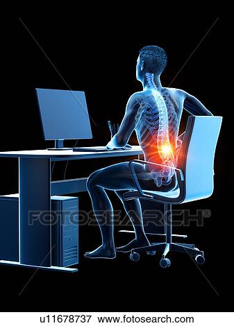 Stock Photo - Office worker with back pain, conceptual illustration.. Fotosearch